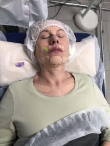 Лимфодренажное тейпирование лица